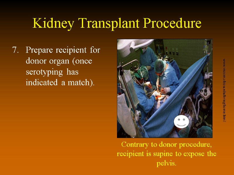 Kidney Transplant Procedure Prepare recipient for donor organ (once serotyping has indicated a match).